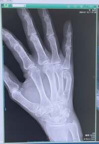 小柳ルミ子『経過観察 結果』