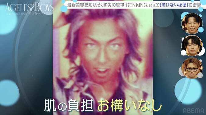 41歳タレント、衝撃のヒアルロン酸注入の施術光景を公開「私が初じゃね？」 5枚目