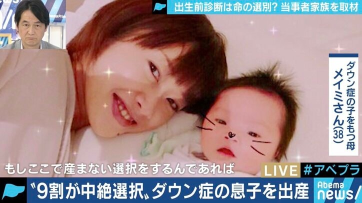 ”9割が中絶を選択” 出生前診断を受け、「命の選択」を迫られた夫婦の苦悩