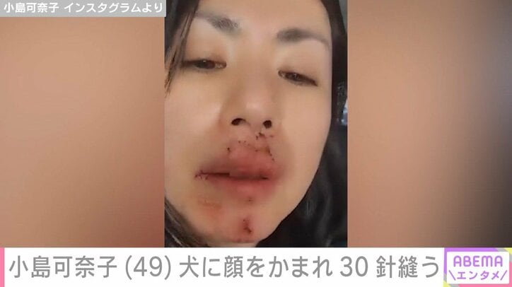 小島可奈子のブログより