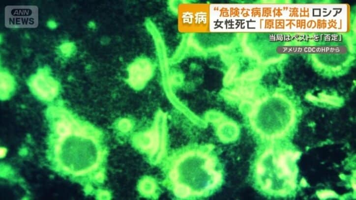 「肺ペスト」に感染の可能性を報じる