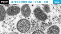 国内初の感染確認「サル痘」とは