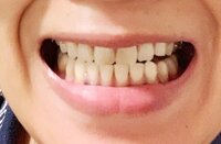 くわばたりえ『☆☆バタる☆40日目☆☆』