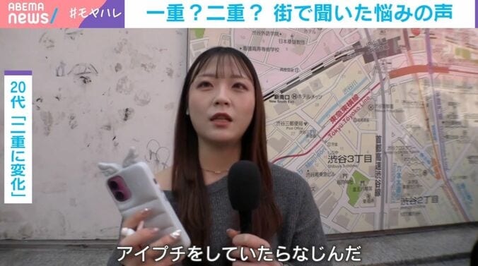 アイプチで二重に変化した20代女性