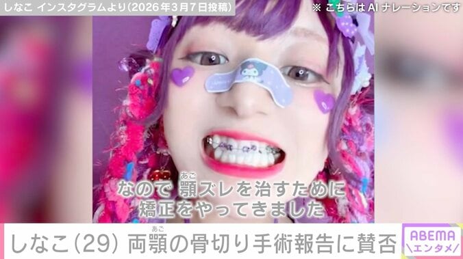 しなこ、両顎の骨切り手術後のダウンタイム中の姿公開に「好感度がより高くなりました」「子ども向けコンテンツ扱う側としては公表する意味ある？」など様々な声 4枚目