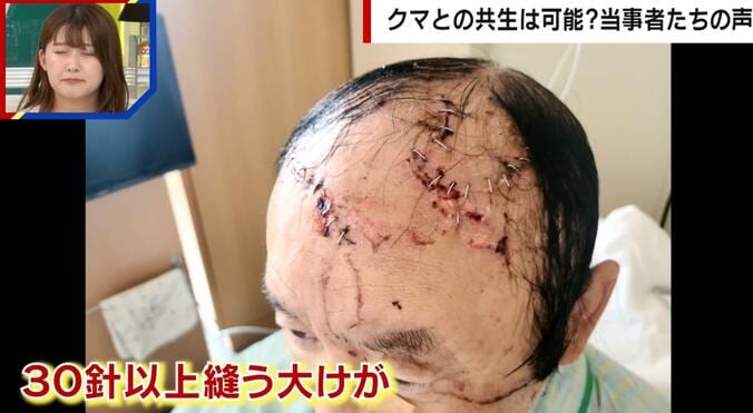 湊屋啓二さん、クマ被害にあった直後の様子