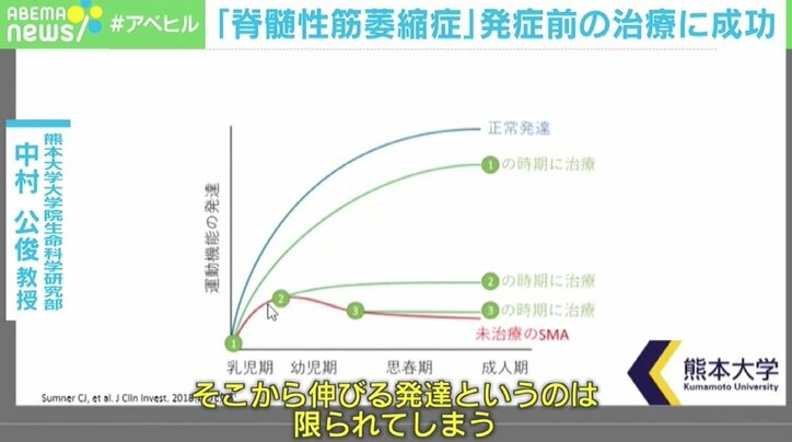 「もっと早くに始められていたら…」 “脊髄性筋萎縮症”発症前の治療に成功も、早期発見の仕組みづくりに課題