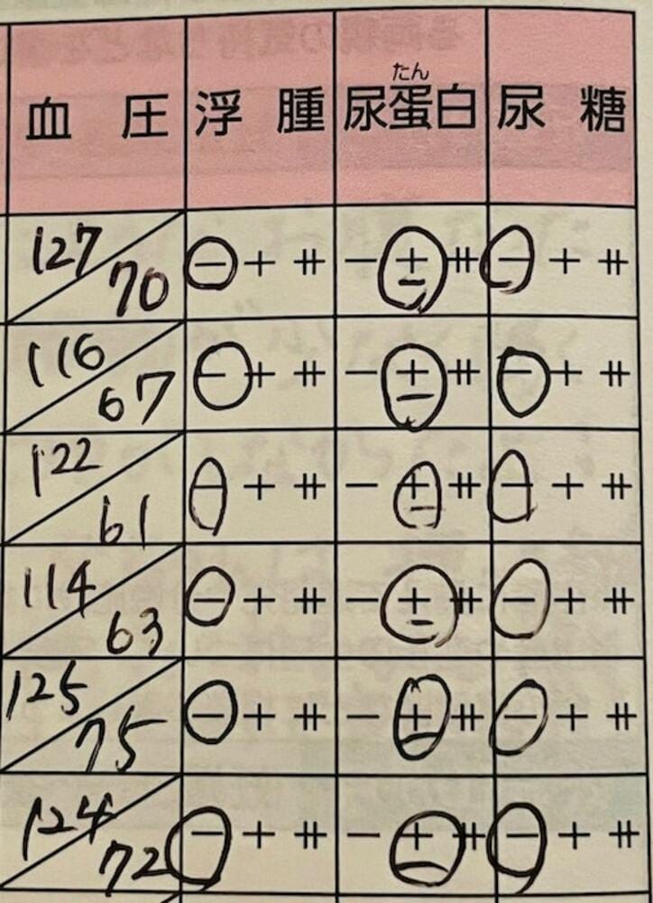  だいたひかる、過去一番の数字が出た健診の結果「通りでゼェゼェする訳だ」 