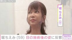 堀ちえみ（59）、目の施術後の姿に反響 「お目目 パッチリ」「本当に綺麗に上がってますね」などの声
