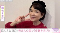 堀ちえみ（59）、2019年の舌がん公表で「非難を浴びた」本音を吐露し「なんてひどいことでしょう」「素晴らしい復活劇です」などの声