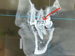 元あいのりメンバー、歯の矯正のために撮影したレントゲンで発覚した衝撃の事実「ショックだった」 