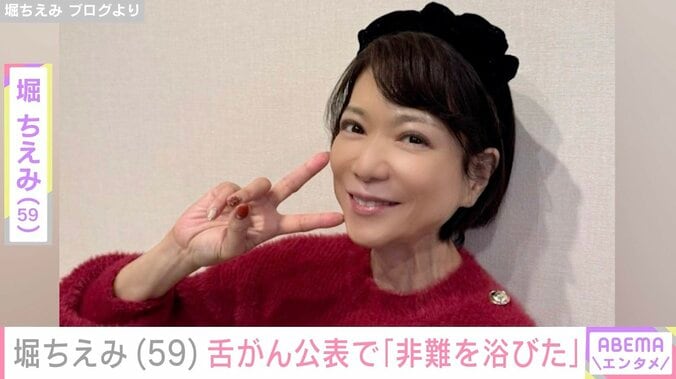 【写真・画像】堀ちえみ（59）、2019年の舌がん公表で「非難を浴びた」本音を吐露し「なんてひどいことでしょう」「素晴らしい復活劇です」などの声　1枚目