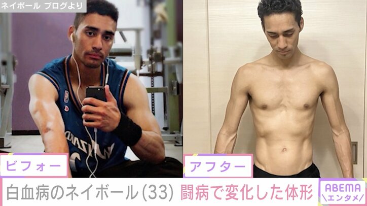 【写真・画像】“10万人に1人”慢性骨髄性白血病の33歳モデル、不妊治療で決断したことを明かし「うまくいきますように」の声 2枚目