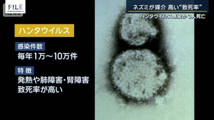 感染リスク