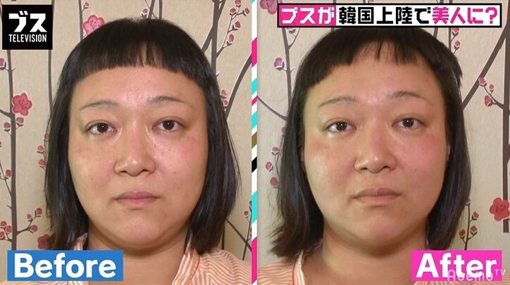 スピワゴ小沢、韓国の整形外科医の衝撃発言を紹介「顔を見たら、どこを直せばアイドルになれるのかわかる」