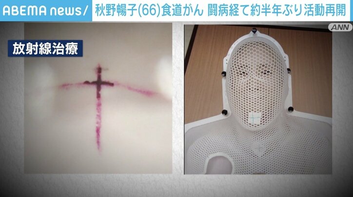 「のどの中に剣山があるような」 秋野暢子さんが約半年ぶりに活動再開 食道がん闘病、放射線治療の激痛でも前を向く“強さ”