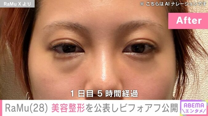 美容整形のアフター