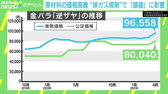 排ガス規制が「銀歯」に影響、原材料のパラジウムが高騰 「100万円前後の持ち出しも…」 3枚目