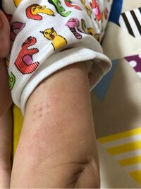 大渕愛子『次男の皮膚に異変…』