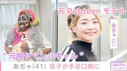 “元祖ヤマンバギャル”2児の母・あぢゃ（41）、息子が手足口病に「可哀想で寝れなかったよ」