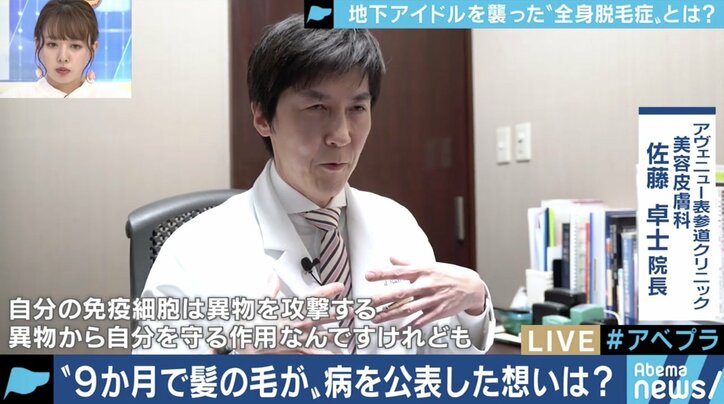 「頭が丸くても続けたい」…全身脱毛症アイドル、告白の裏にファンの後押しも