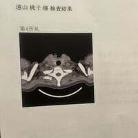 桃『人間ドックの結果に唖然…。』