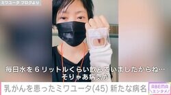 乳がんで左胸全摘出したバンドボーカル・ミワユータ、検査入院で新たな病名「毎日水を6リットルくらい飲んでいましたからね…」