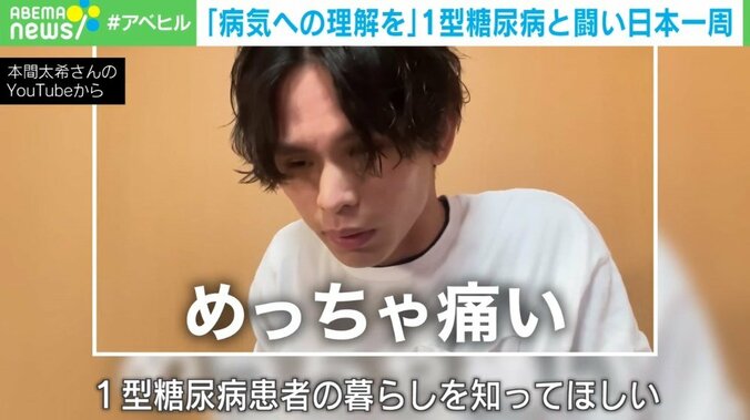 「糖尿病＝生活習慣病じゃない！」自転車日本一周で打ち砕きたかった「1型糖尿病」への偏見 3枚目