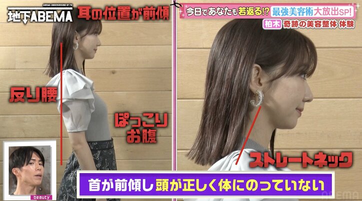 【写真・画像】柏木由紀、「1回20万円」の美容整体で衝撃の変化「怖い!」ビフォアフに驚きの声 2枚目