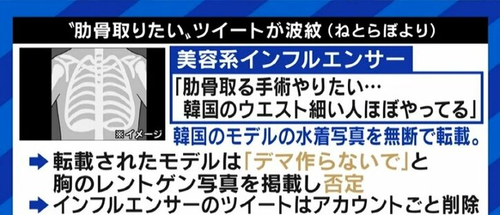 "肋骨を除去する手術"に美容外科医「転んだ際に危険」なぜ過度な細さを求める？元アイドル「インスタにあげる写真は全て加工している」