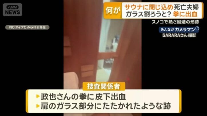 政也さんの拳には皮下出血