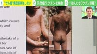 "サル痘"集団感染しない? 天然痘ワクチンを検討