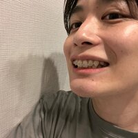 しょうくん『31歳から始める歯列矯正 〜2ヶ月後〜』