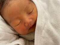 桃『じろ生後1週間、黄疸の再検査と眼瞼下垂の可能性』