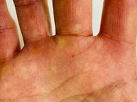 薬丸裕英『回復に向かう』