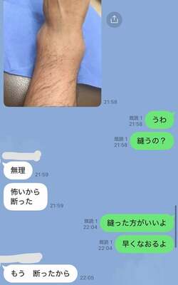  川崎希、夫・アレクが負傷し急いで病院を受診「10件目くらいに電話して」 