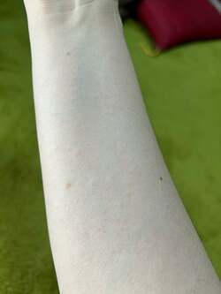  ノッチの妻、病院の受診も検討する謎の症状「腕の内側のみなんやろ？」 