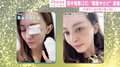 田中理恵、顔のやけどの回復を報告「すごく綺麗に治りました」