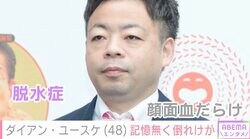 ダイアン・ユースケ（48）、“脱水症“で記憶無く倒れ顔面殴打し鼻血「打ちどころ悪かったら…って考えるとめちゃくちゃ怖い」ファン心配