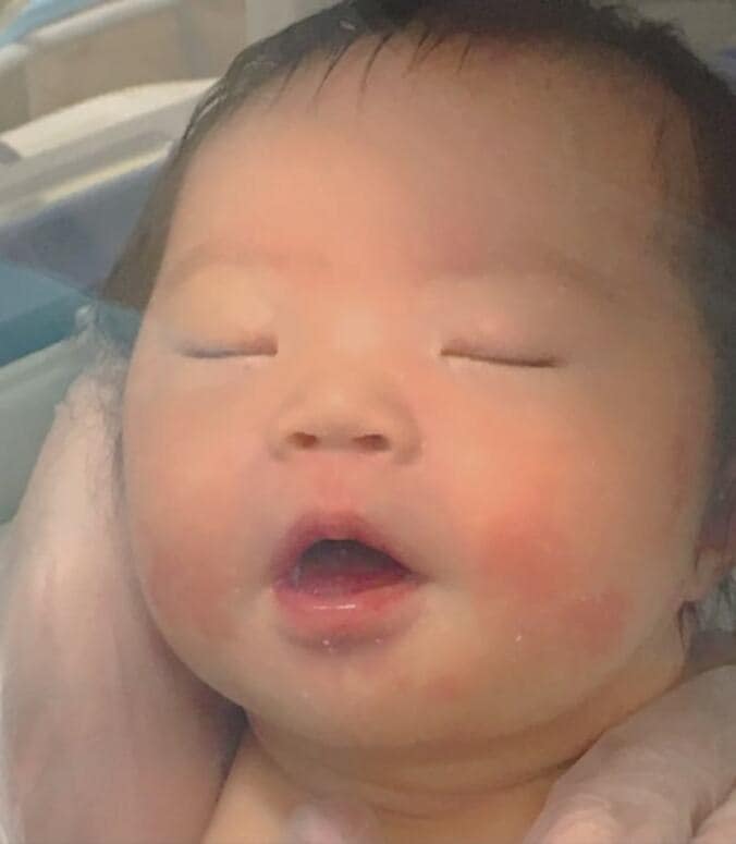 漫談家で介護福祉士のメイミさん、 出生前診断について夫と意見がぶつかり涙「出産を諦める方が良いんじゃないか」  1枚目