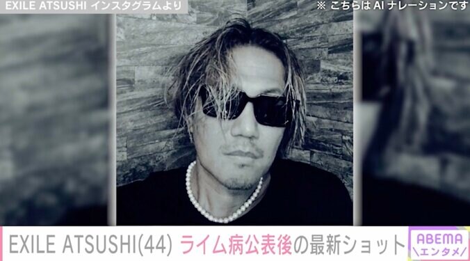 【写真・画像】ライム病公表のEXILE ATSUSHI(44) 半年ぶりにインスタ更新 最新ショットを披露「髪の毛も伸びてきて…」　1枚目