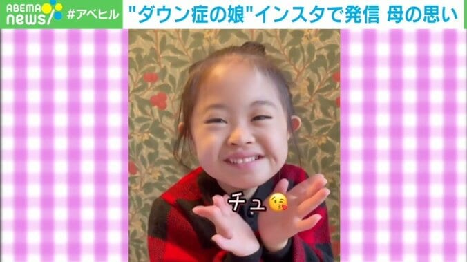 ダウン症の娘をインスタで発信 「少しでも多くの方に見つけてもらいたい」母の思い 1枚目