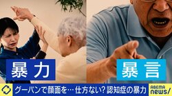 顔・頭を蹴られ、同僚は首を締められ…認知症患者に向き合う看護師たちの苦悩「身構えながら働くのが普通に」4人に1人は日常的に被害