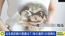 10年で検査数が4倍に「出生前診断」の是非 産む決断、産まない決断、それぞれの葛藤 専門医「家族の環境によって全く違う」
