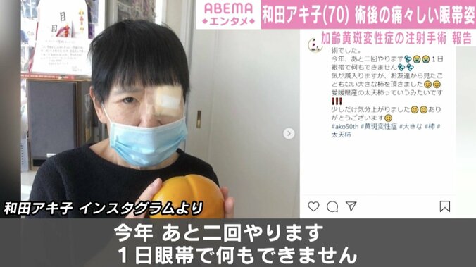 「気が滅入りますが…」和田アキ子、黄斑変性症の注射手術で痛々しい眼帯姿を公開 1枚目