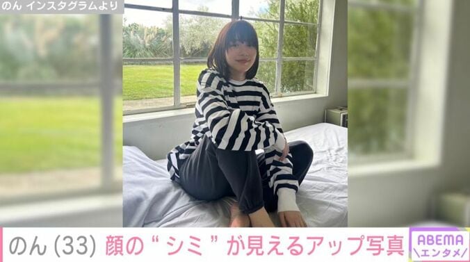 のん