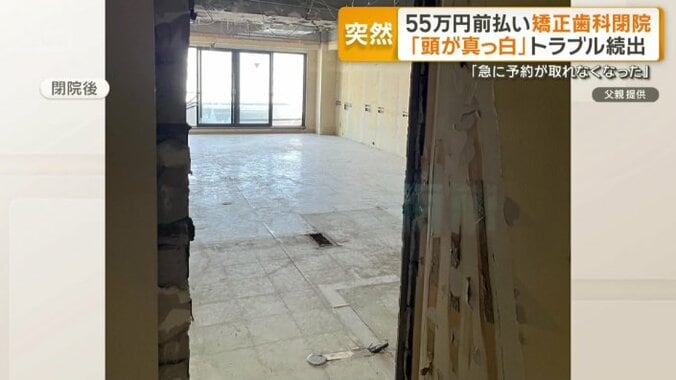 「跡形も面影もない…」上野の矯正歯科