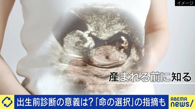 増える出生前診断