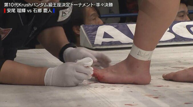 「指が裂けたようだ」「痛そうで見てられない」ファン悲痛なアクシデント ローブローも重なる不運をはねのけダウン奪う激勝 4枚目