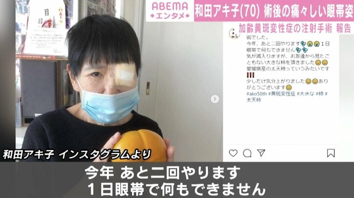 「気が滅入りますが…」和田アキ子、黄斑変性症の注射手術で痛々しい眼帯姿を公開
